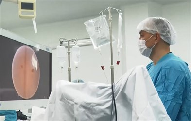 В УФе врачи МГУ имени М.В. Ломоносова провели уникальную операцию на мочевом пузыре